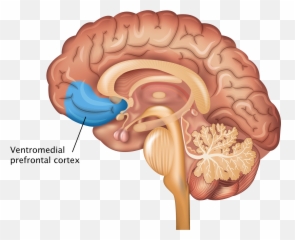 Prefrontal Cortex - Complications Of Diabetes Stroke Emoji,Part Of The Brain For Emotions