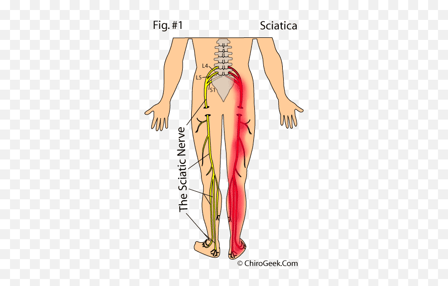 Sciatica Leg Pain U0026 Radiculopathy Advice By A World - Muscle Runs Down The Back Of Your Leg Emoji,All These Negative Emotions Towards Me Are Hurting Me Nervous System.