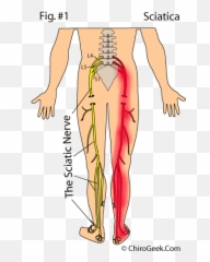 Sciatica Leg Pain U0026 Radiculopathy Advice By A World - Muscle Runs Down The Back Of Your Leg Emoji,All These Negative Emotions Towards Me Are Hurting Me Nervous System.