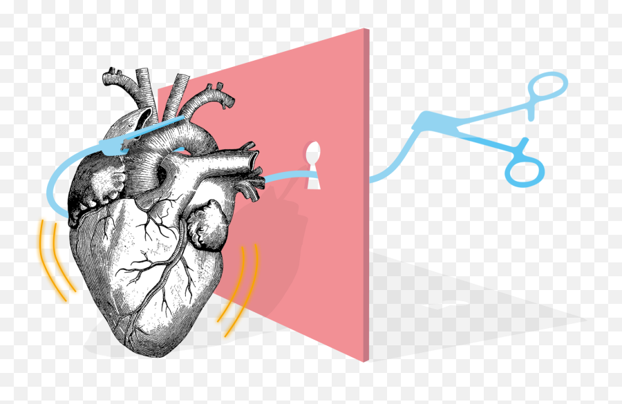 Heart Surgery U2013 Tum U2013 150 Jahre Culture Of Excellence - Minimally Invasive Surgery Animation Emoji,Giant Heart Emoji