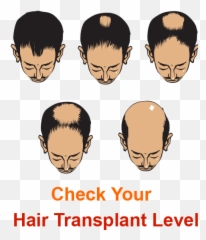 Asg Hair Transplant Centre Semantictrade Emoji,Chester Burnett That Petrol Emotion