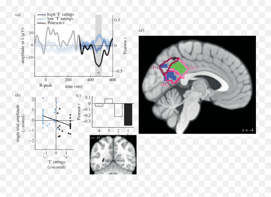 The Trial - Bytrial Amplitude Of Hers In The Ventral Language Emoji,Paralimbic Syndroms No Emotions