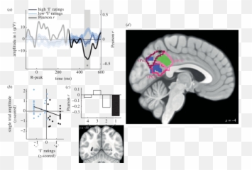 The Trial - Bytrial Amplitude Of Hers In The Ventral Language Emoji,Paralimbic Syndroms No Emotions