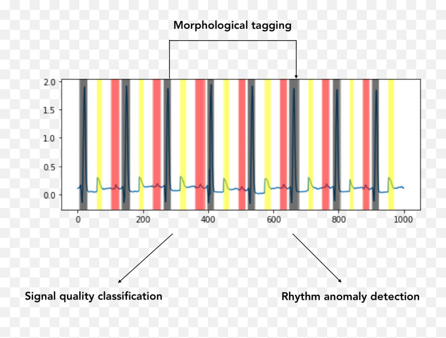 Multitask Learning Teach Your Ai More To Make It Better Emoji,Ecg Emotion Measure