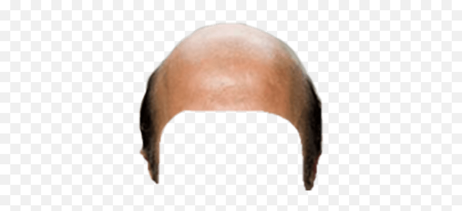 Bald Head Snapchat Filter Transparent Png - Stickpng Bald Hair Png Emoji,Bald Emoji