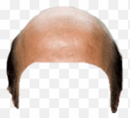 Bald Head Snapchat Filter Transparent Png - Stickpng Bald Hair Png Emoji,Bald Emoji