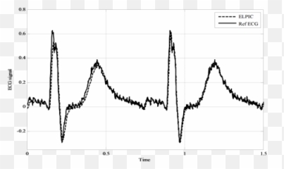 Generalized Attack Model For Networked Control Systems Emoji,Ecg Emotion Measure