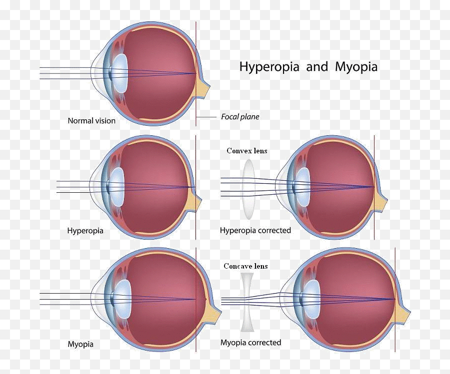 Memo Everyday Flashcards - Glasses For Myopia Emoji,Theories Of Emotion Mcat Mnemonics