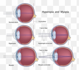 Memo Everyday Flashcards - Glasses For Myopia Emoji,Theories Of Emotion Mcat Mnemonics