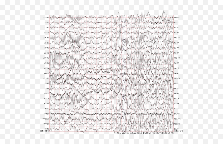 Can Brain Waves Travel In Space Or In - Radio Waves Vs Brain Emoji,Brain Waves Emotions