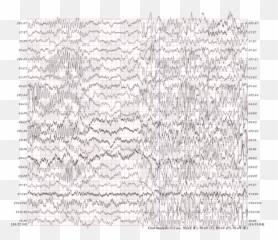 Can Brain Waves Travel In Space Or In - Radio Waves Vs Brain Emoji,Brain Waves Emotions