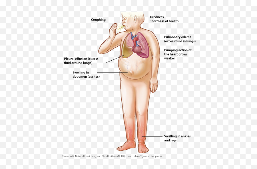 Httpseleisawifelifecom20210130hotteok - Koreabfried Congestive Heart Failure Emoji,Kimchi Cuddles Emotion