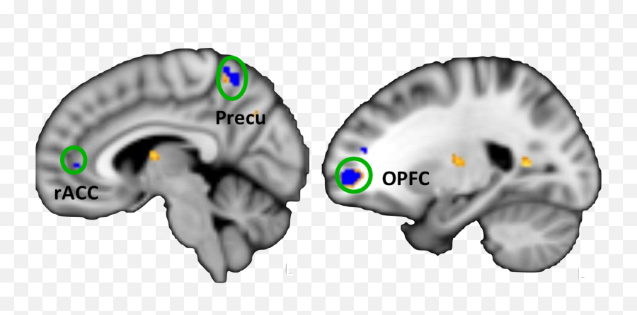Vagus Tvns U2014 Brainhopecom Emoji,Fc3s Work Emotion Vagus Tvns U2014 Brainhopecom Emoji,Fc3s Work Emotion
