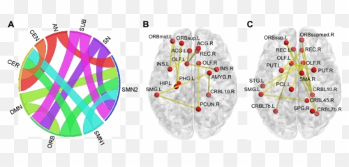 Increased Positive Functional Connectivities In Patients Emoji,Paralimbic Syndroms No Emotions