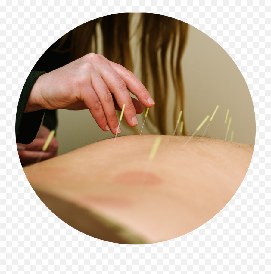 Earth Sea Acupuncture - Acupuncture Emoji,Acupuncture Sites On Back For Emotions