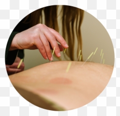 Earth Sea Acupuncture - Acupuncture Emoji,Acupuncture Sites On Back For Emotions