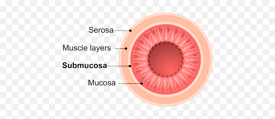 Technologies - Cook Biotech Small Intestine Submucosa Emoji,Emotion Code Small Intestine Acen