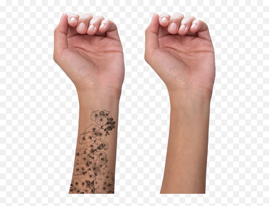 Best Tattoo Removal Clinic In Hyderabad Best Dermatologist - Temporary Tattoo Emoji,Emotion Expressing Tattoos