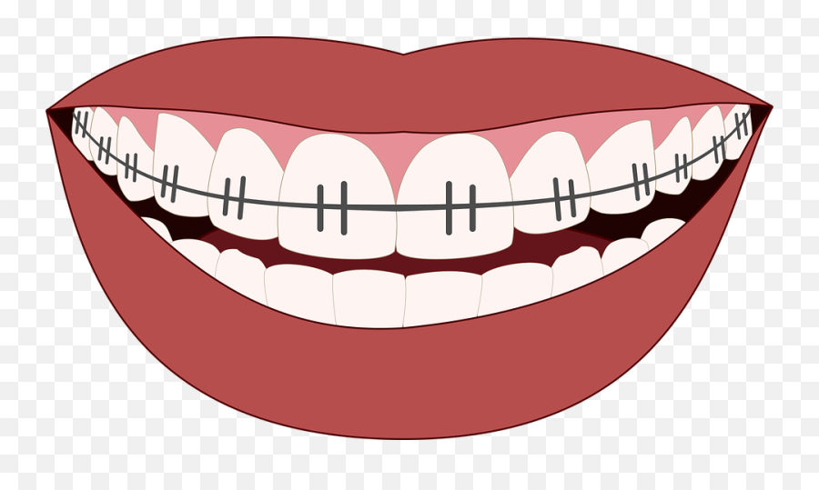 Picture - Cartoon Mouth With Braces Emoji,Braces Smile Emoji