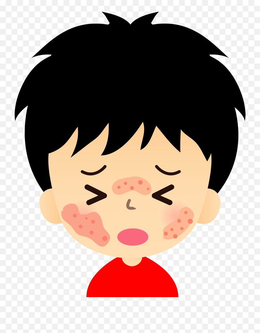 Skin Rash - Dermatitis Eczema Or Hives Clipart Free Skin Rash Clipart Emoji,Itching Emoji