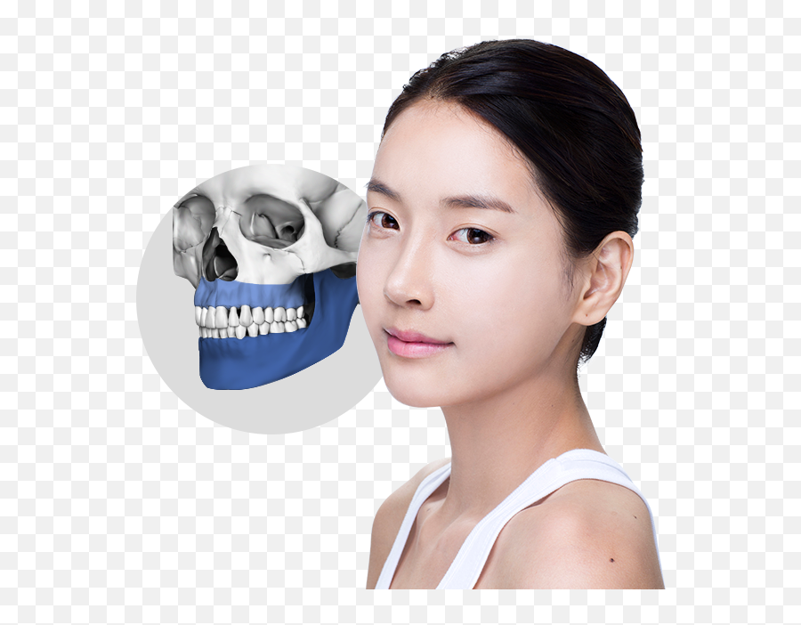 Two Jaw Surgery Emoji,Facial Assymtry Of Emotion