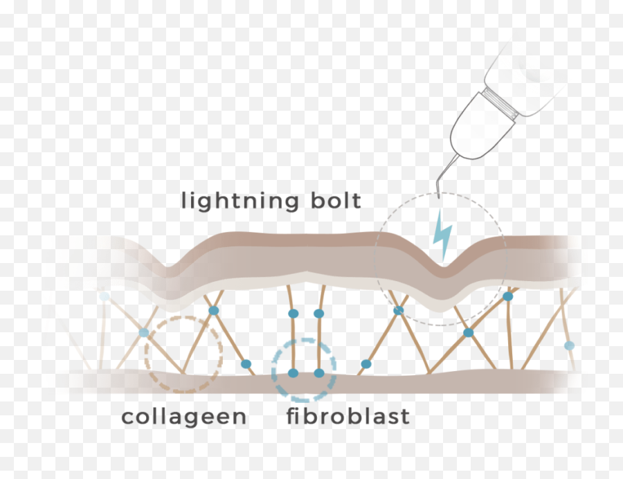 Online Courseeng - Privé Academy Works Fibroblast Skin Tightening Emoji,Text Emoticons Lightning Bolt