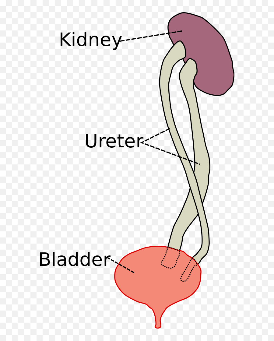 Duplicated Ureter - Ureteral Duplication Emoji,Emojis That Lead From The Kidney To The Urinary Bladder