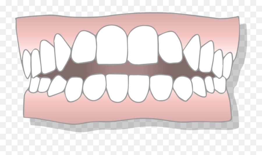 What Is An Open Bite Types Causes U0026 Treatments Emoji,How Do You Type Out The Smile With Teeth Emoticon In Facebook