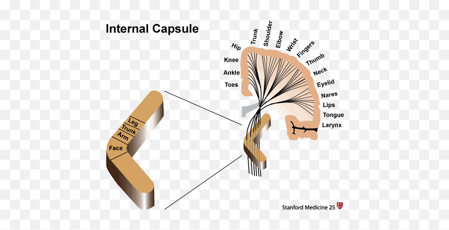 Internal Capsule Stroke Stanford Medicine 25 Stanford Emoji,Cortical Lesion Emotion Sight Internal Capsule Stroke Stanford Medicine 25 Stanford Emoji,Cortical Lesion Emotion Sight