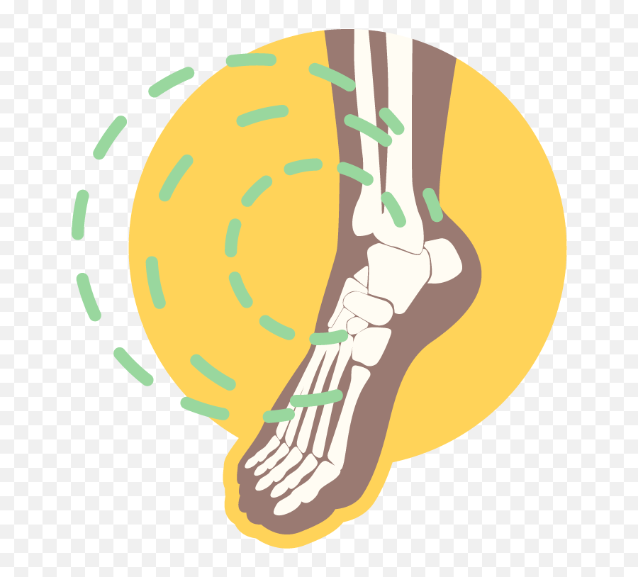 Conservative Treatments Exercises U0026 Rehab Kansas City - Ankle Joint Clipart Emoji,Hayward On Emotions Of Ankle Injury