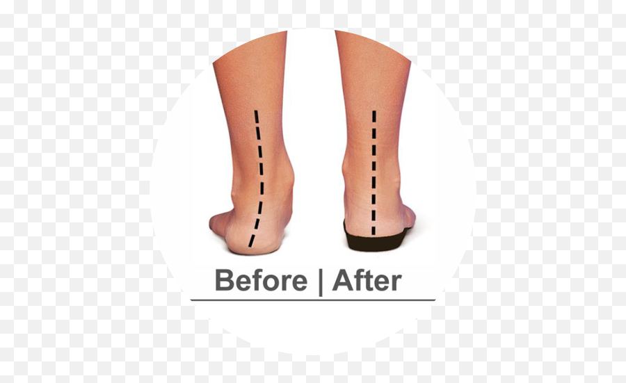 Orthotics In Boca Raton Fl - Medial Arch Support Insoles Emoji,Emotions In The Soles Of Your Feet