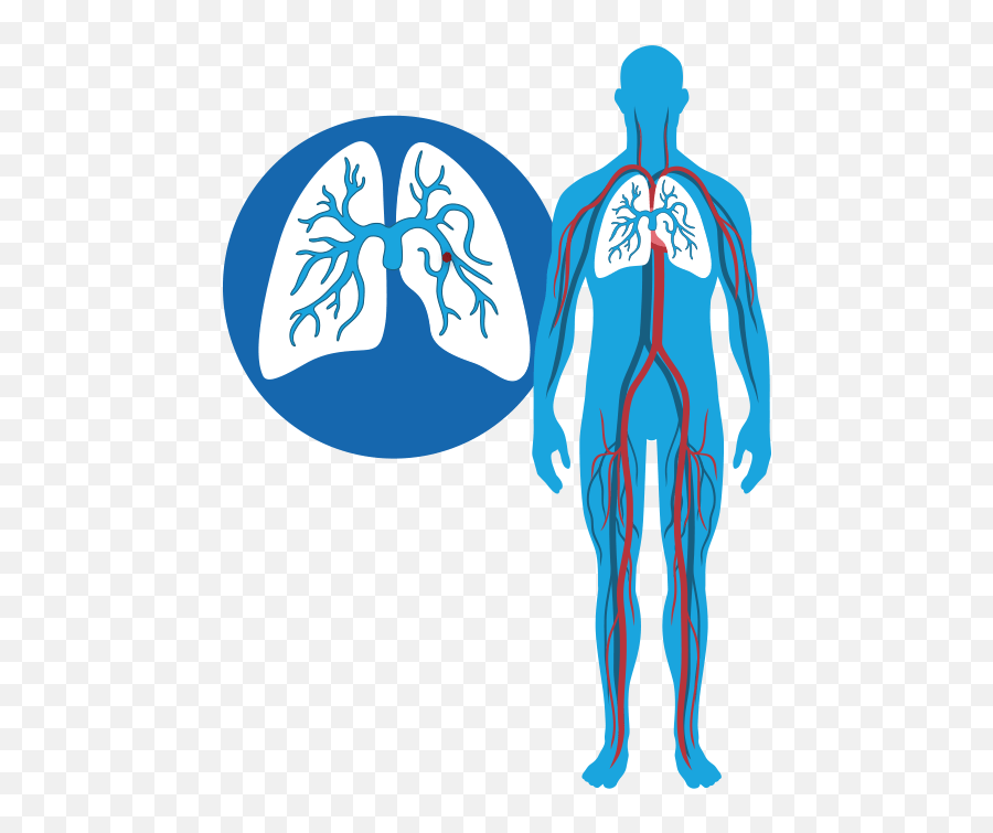 Symptoms Fast - Dvt Pe Emoji,Medical Field Where Human Emotions Are Deep