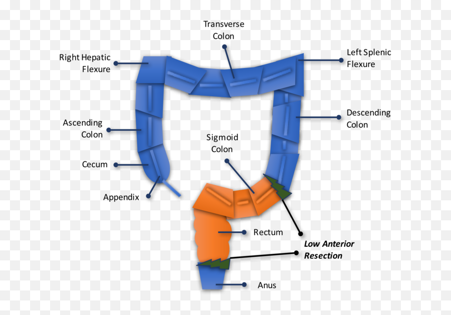 Low Anterior Resection Surgery Love - Low Anterior Resection Emoji,Emotions Of The Splenic Flexure