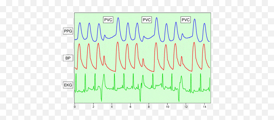 What Does Perf Mean On A Heart Monitor - Dot Emoji,Anesthesiology Emojis