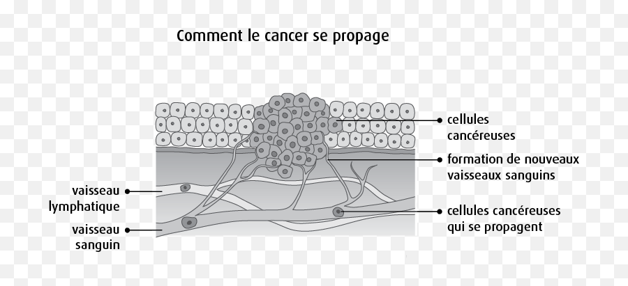 Comment Le Cancer Se Forme Se Développe Et Se Propage - Formation D Un Cancer Emoji,Emotion Piece Propag