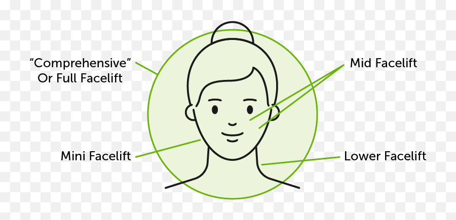 Facelift - Beverly Hills Ca Dr Nima Eos Rejuvenation Dot Emoji,Drawing Of Faces Showing Emotion Contour Lines