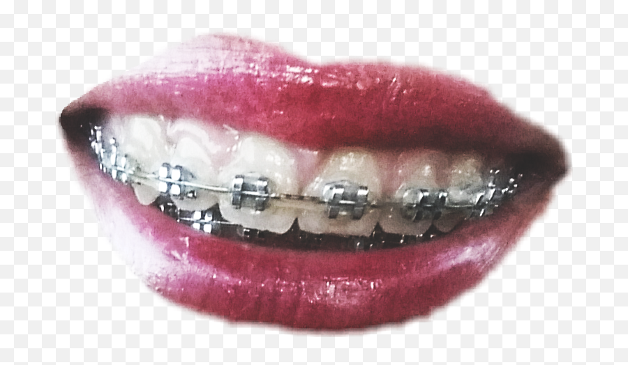 Smile Braces Lips Mouth Sticker - Oral Hygiene Emoji,Braces Smile Emoji