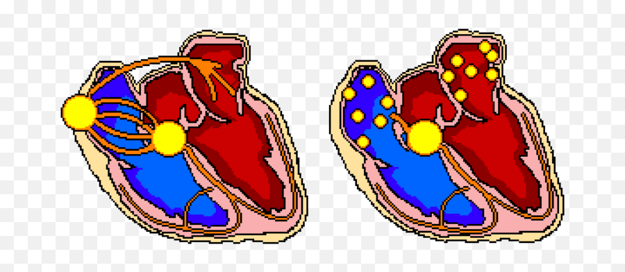 Christopher U2013 The Student Physiologist - Atrial Fibrillation Emoji,Emotion Ecg