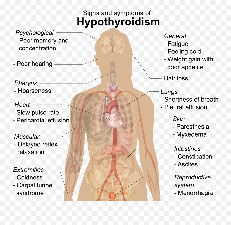 Thyroid Treatment In Homeopathy Homeopathy Online - Hypothyroidism Emoji,Body Heat Emotion Chart