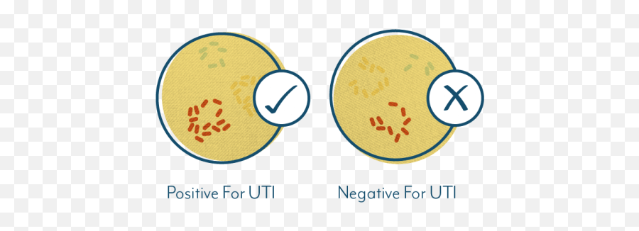 Why Your Uti Test May Be Negative Even If You Have Symptoms - Urine Culture Clipart Emoji,Blue Chair Throwing Away Negative Emotions