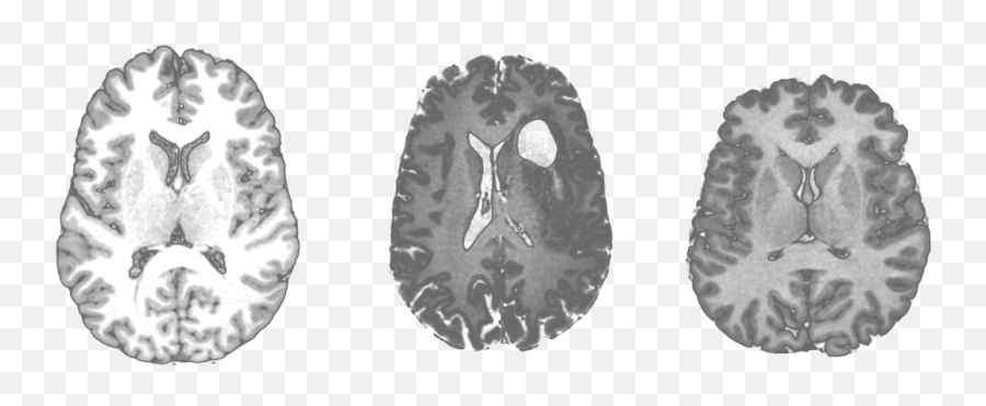 What Is Connectomics - Dot Emoji,Mri Scans Of Different Emotions