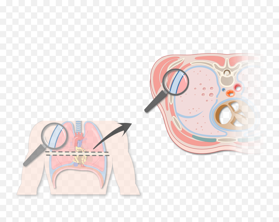 Pleura Or Pleurae And Pleural Cavity Of The Lungs Emoji,Visceral &/or Emotions