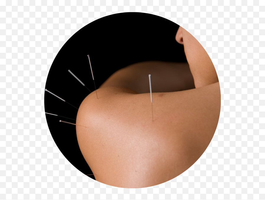 Acupuncture - Allegra Spas Dry Emoji,Stomach Meridian Emotions