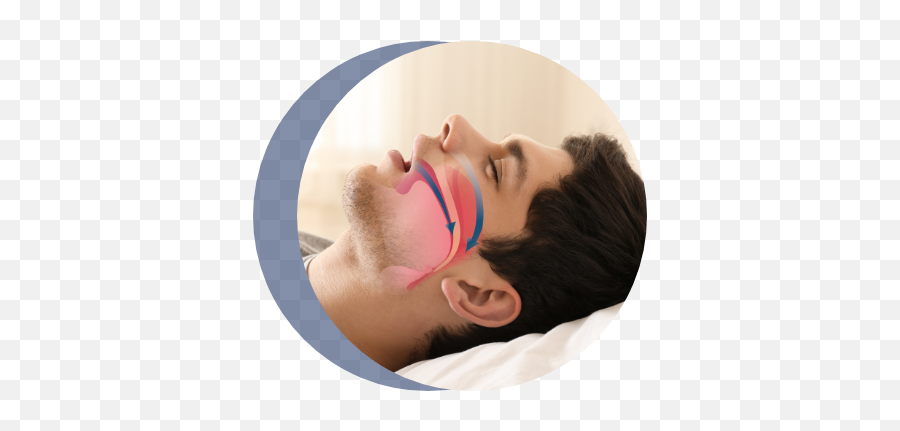 Sleep Disorders - Cpap Para Apneia Do Sono Emoji,A Series Of Thoughts, Images, Or Emotions Occurring During Sleep
