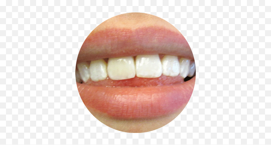 Restoration Dr Matthew S Ginsburg Dmd - Happy Emoji,Gap Tooth Emoticon