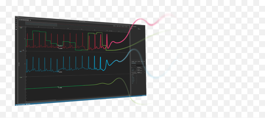 Ecg Signal Powerlab Ecg Studies For Human U0026 Animal - Horizontal Emoji,Emotion Ecg