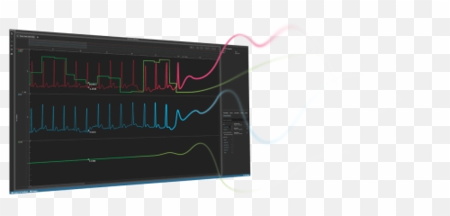 Ecg Signal Powerlab Ecg Studies For Human U0026 Animal - Horizontal Emoji,Emotion Ecg