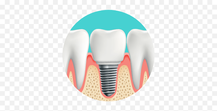 Restoration Dr Matthew S Ginsburg Dmd - Dental Implants Vector Emoji,Gap Tooth Emoticon