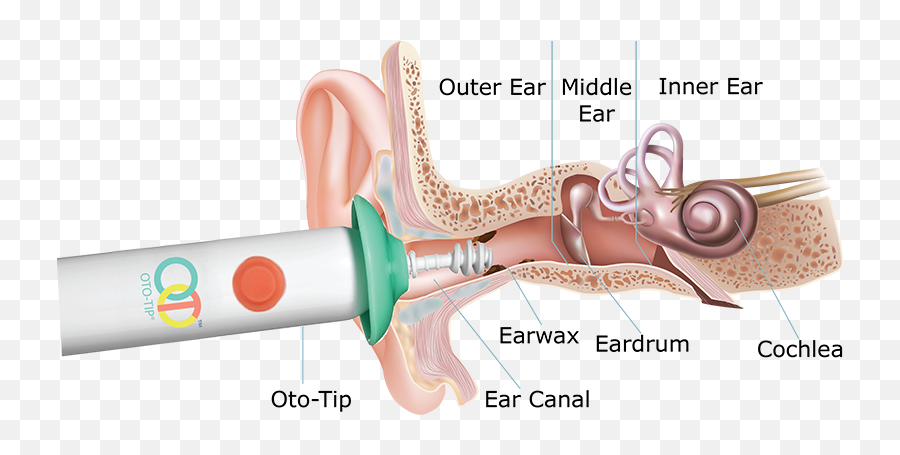 How To Clean Ears With Q Tips Why You Shouldn T Use Q Tips - Clear Ear Oto Tip Emoji,Ear Of Rice Emoji Transparent