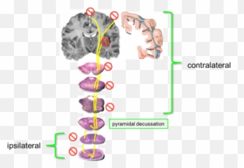 Tc5 Neuro Lesions Flashcards Quizlet Emoji,Papez Circuit Emotion